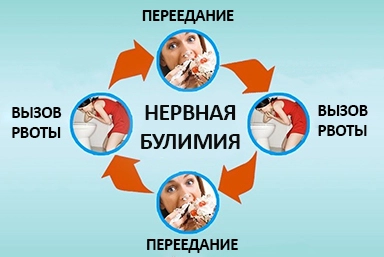 Лечение булимии в Кожевниково
